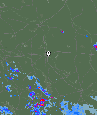 Radar