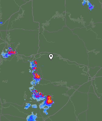 Radar