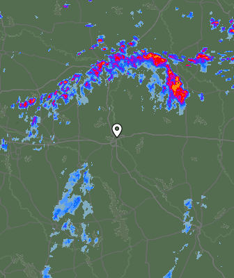 Radar