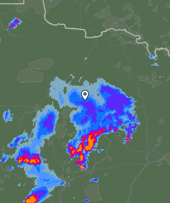 Radar