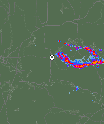 Radar