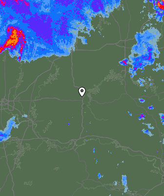 Radar