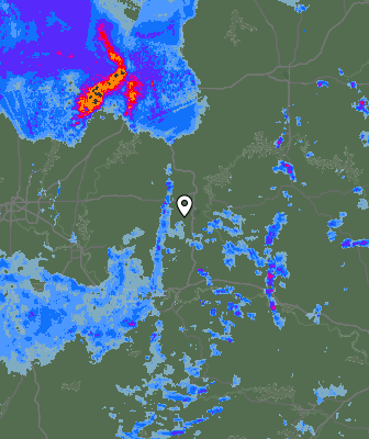Radar
