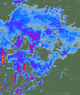 Radar