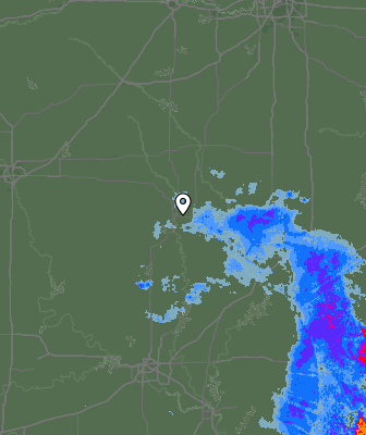 Radar