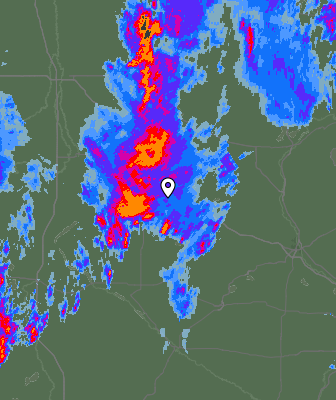 Radar