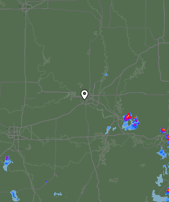 Radar