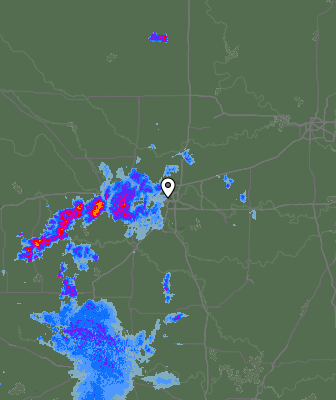 Radar