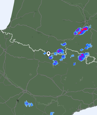 Radar