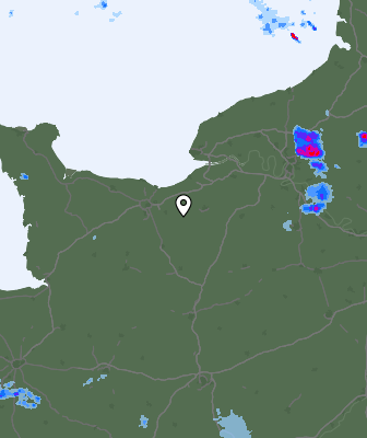 Radar