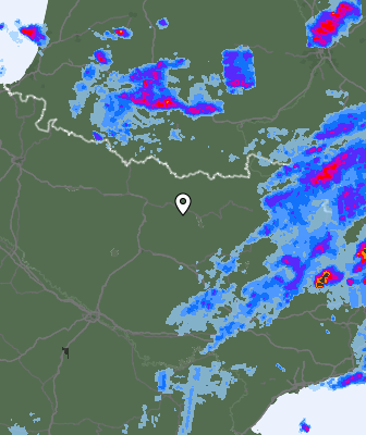 Radar