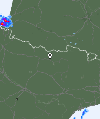 Radar