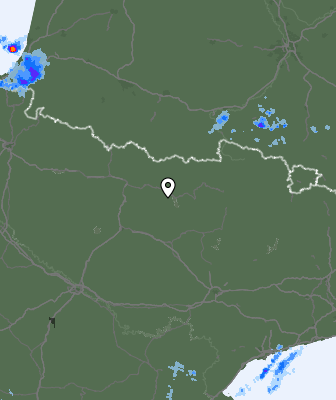 Radar