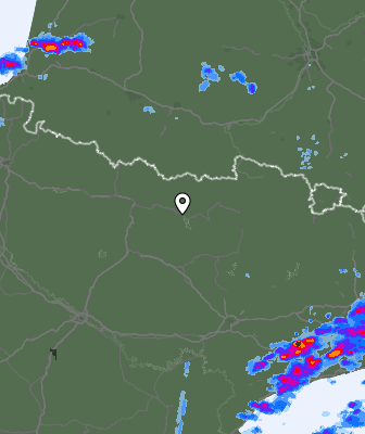 Radar