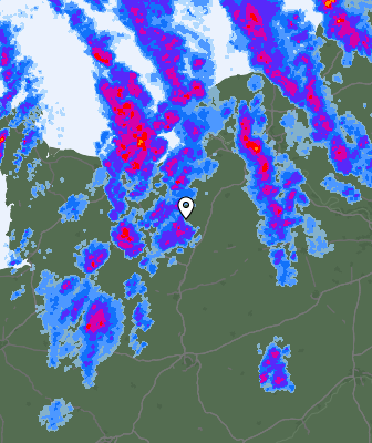Radar