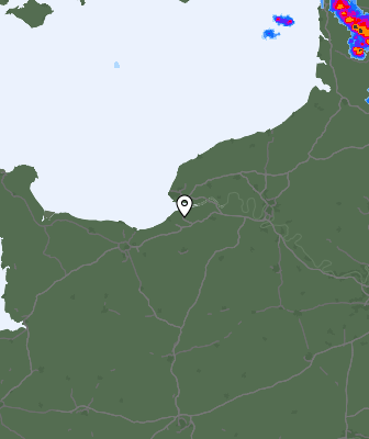 Radar