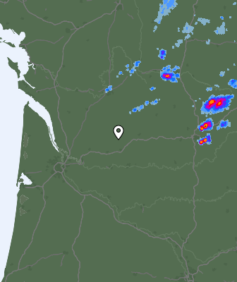 Radar