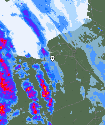 Radar
