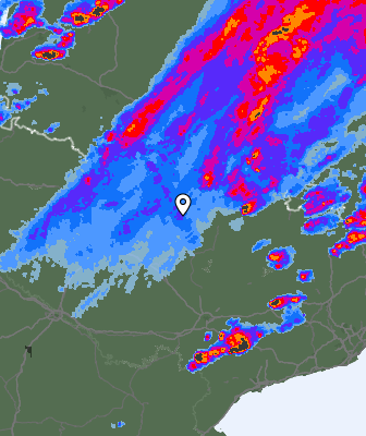 Radar