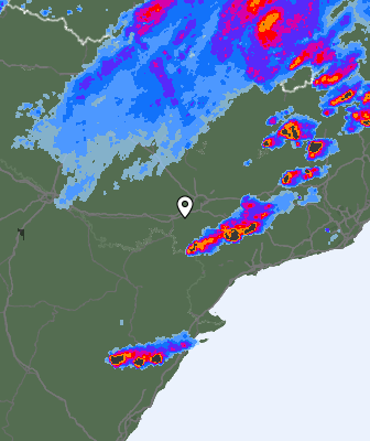 Radar