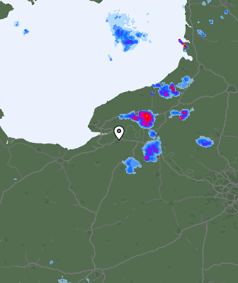 Radar