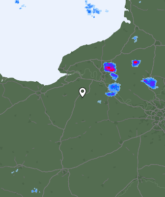 Radar