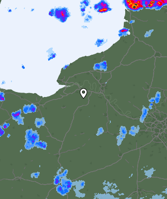 Radar