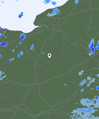 Radar