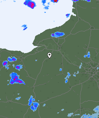 Radar