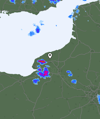 Radar