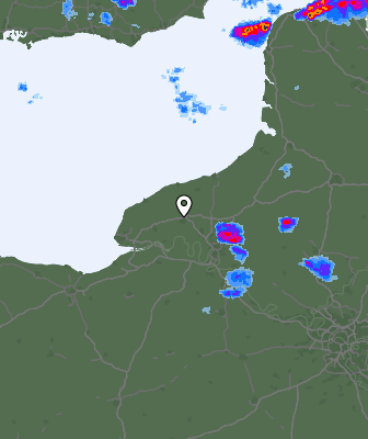 Radar