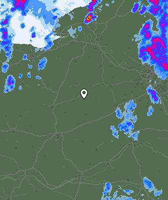 Radar