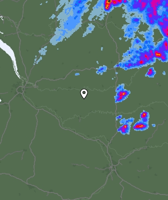 Radar
