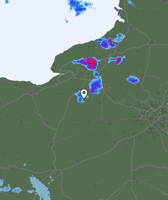 Radar