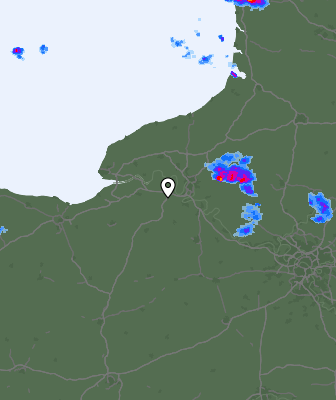 Radar