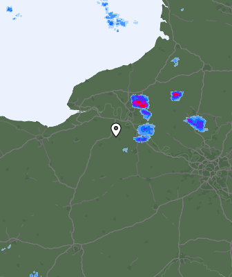Radar