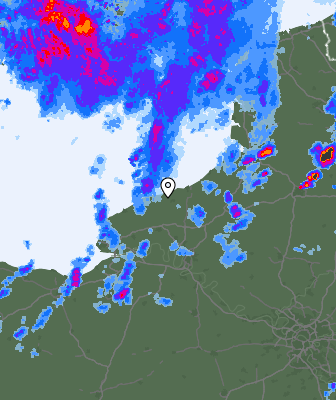 Radar
