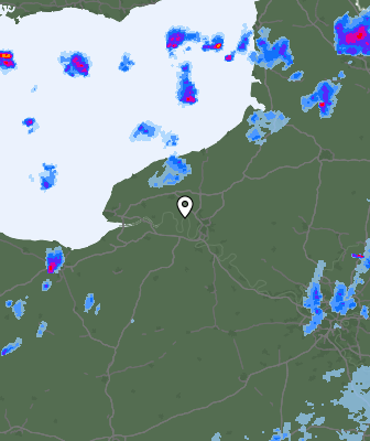 Radar