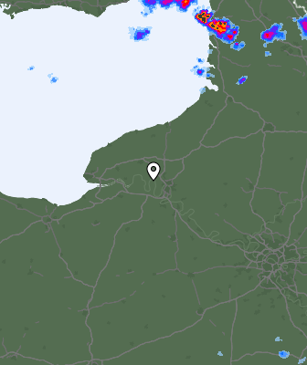 Radar
