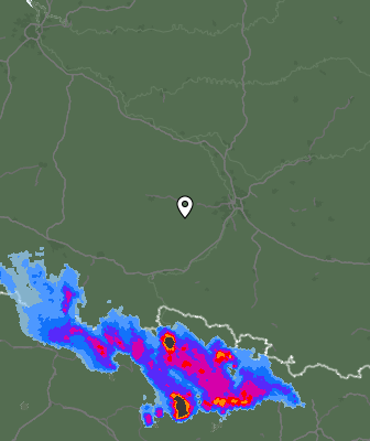 Radar
