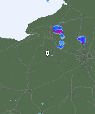 Radar