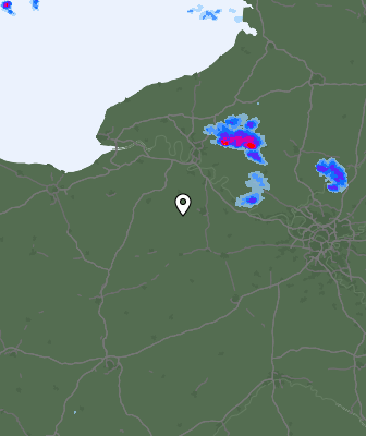 Radar