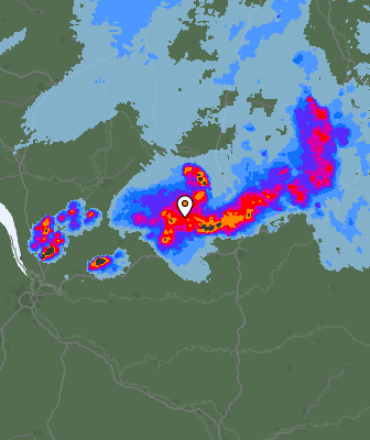 Radar