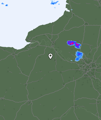 Radar