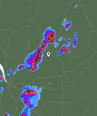 Radar