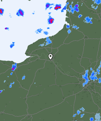 Radar