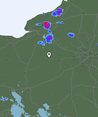 Radar