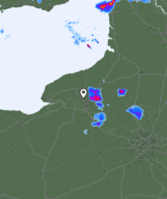 Radar