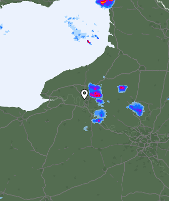 Radar