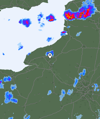 Radar